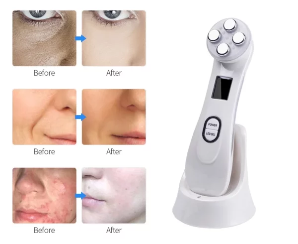 Masseur faciale radio fréquence – Image 3